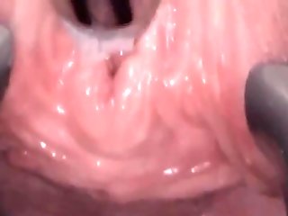 Hole Sounding and Fucking Dildo. Urethral Insertion